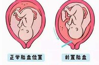 详细解读钦州市做长方案试管婴儿费用，长方案和短方案成功率有差别吗？